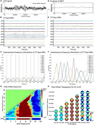 Evaluating the Different Stages of Parkinson’s Disease Using Electroencephalography With Holo-Hilbert Spectral Analysis